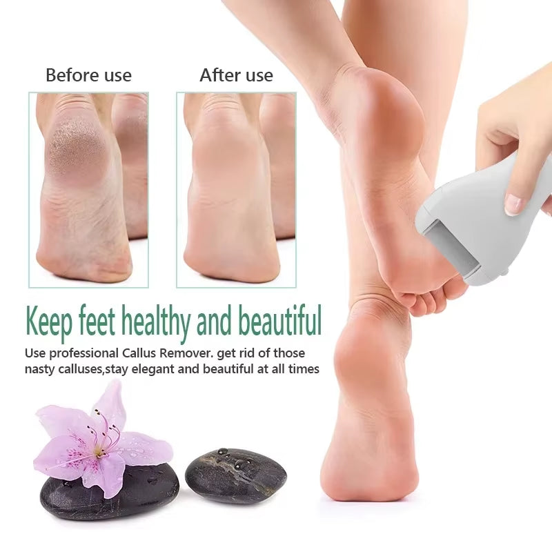 Electric Pedicure Foot File USB Rechargeable Power Display 3Pcs Grinding Exfoliator Replacement Heads for Heel Callus Remover